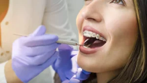 أنواع الأسنان التي تحتاج إلى تقويم