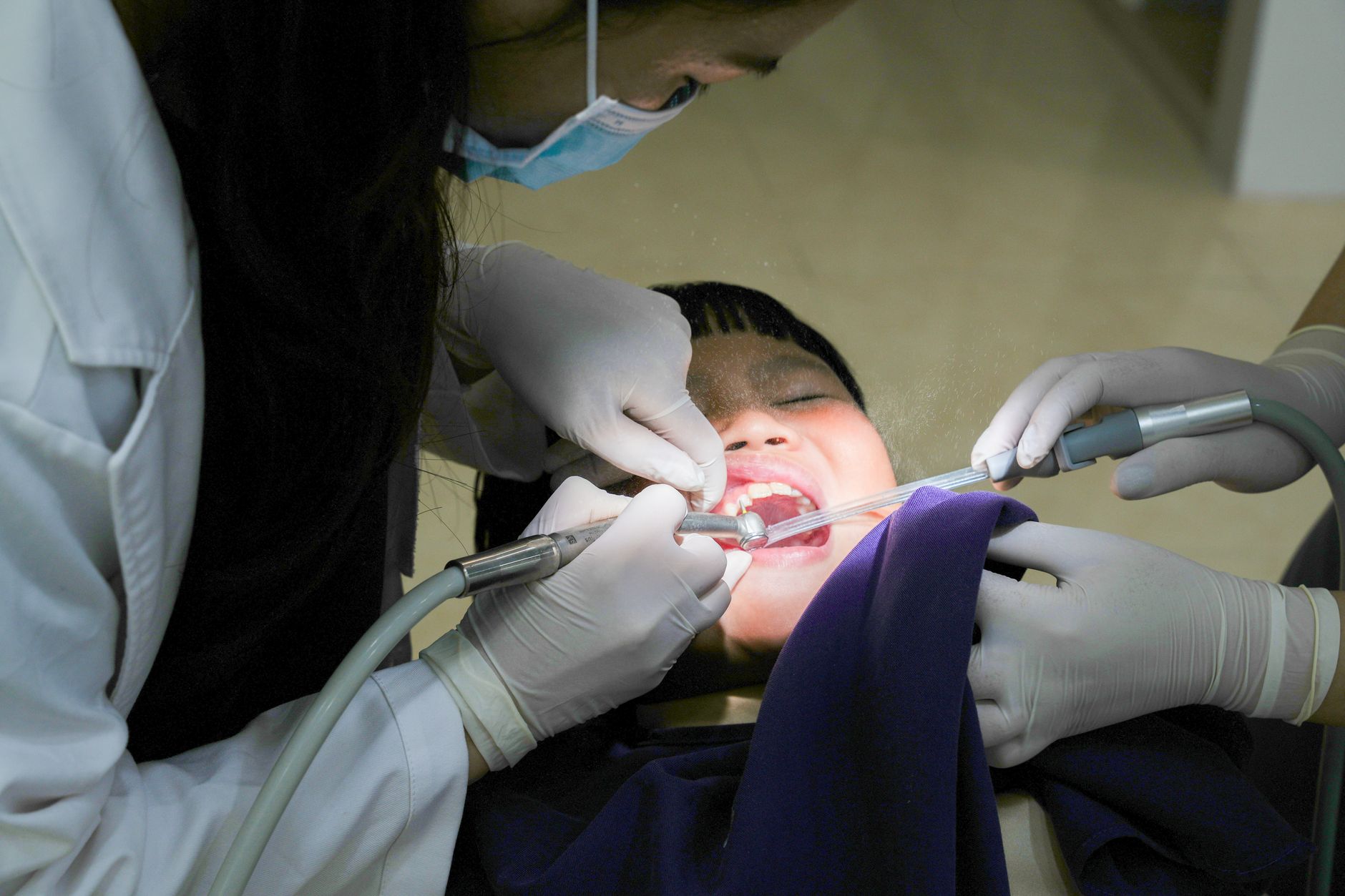 أسعار تركيب طقم أسنان متحرك